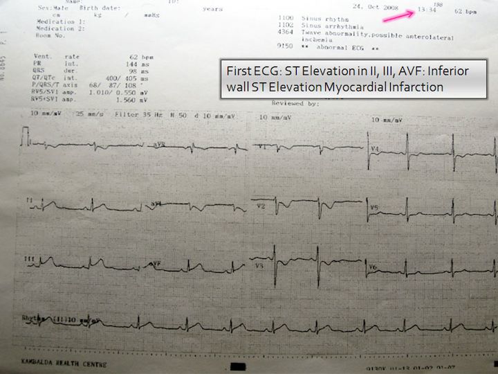 Initial ECG chart, 1:34 pm.