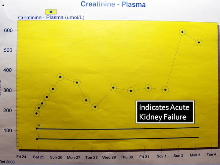 A measure of kidney function (low is bad) showing that kidney failure occurred for over a week.