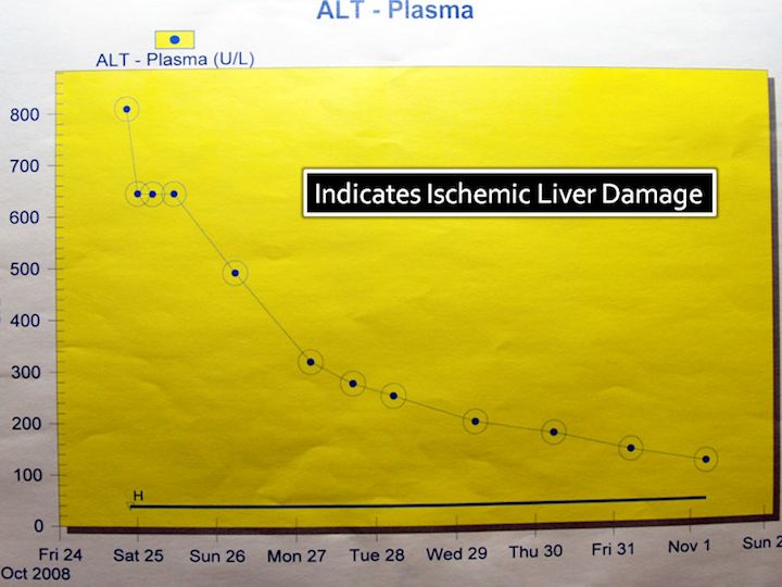 Graph of liver function, showing significant damage on 25th October.